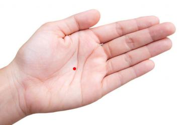 Có 4 nốt ruồi này, không giàu sang cũng phú quý SUỐT ĐỜI