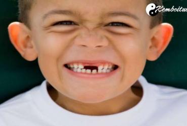 Bật Mí Ý Nghĩa Giấc Mơ Thấy Gãy Răng - Điềm Tốt Hay Xấu?