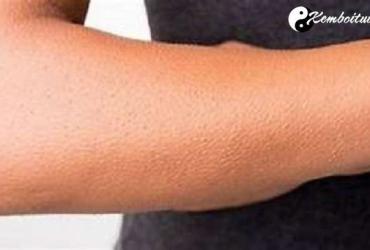 Giải mã hiện tượng nổi da gà là điềm gì, tốt hay xấu?